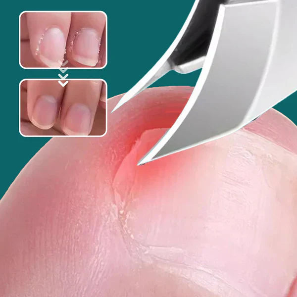 Anti-slap negleklipper med skrå kant, sæt med 3 dele